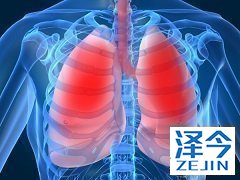 尼达尼布治疗难治性 CRC 收效甚微