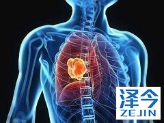 尼达尼布与多西紫杉醇能够为患者提供收益吗