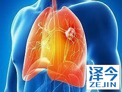 尼达尼布具在三种有效成分