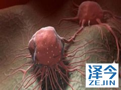 尼达尼布为MPM患者提供治疗作用