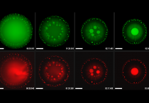 白血病三代药普纳替尼（Ponatinib）效果和副作用简介